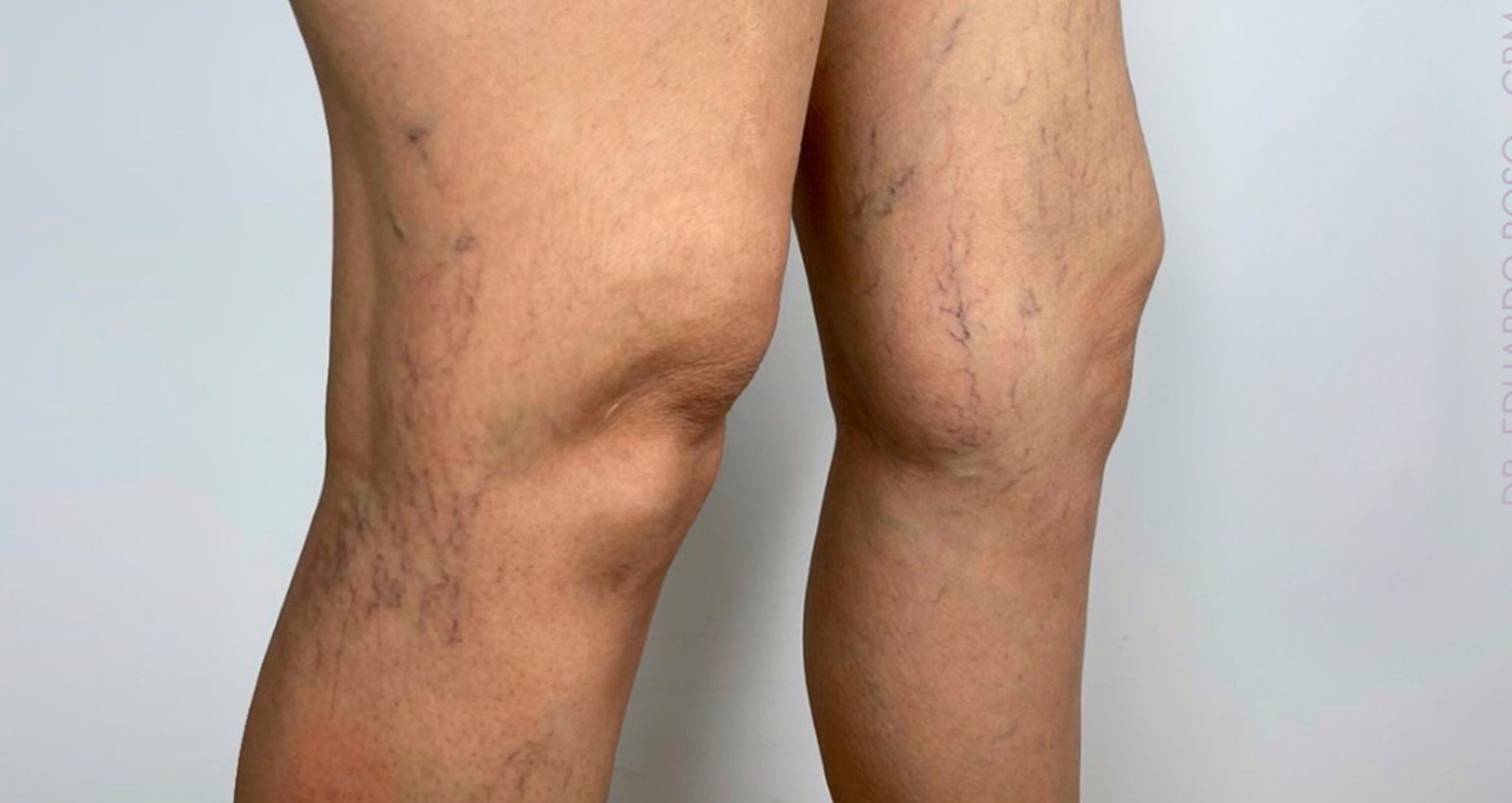 Prancheta 1 copiar 4