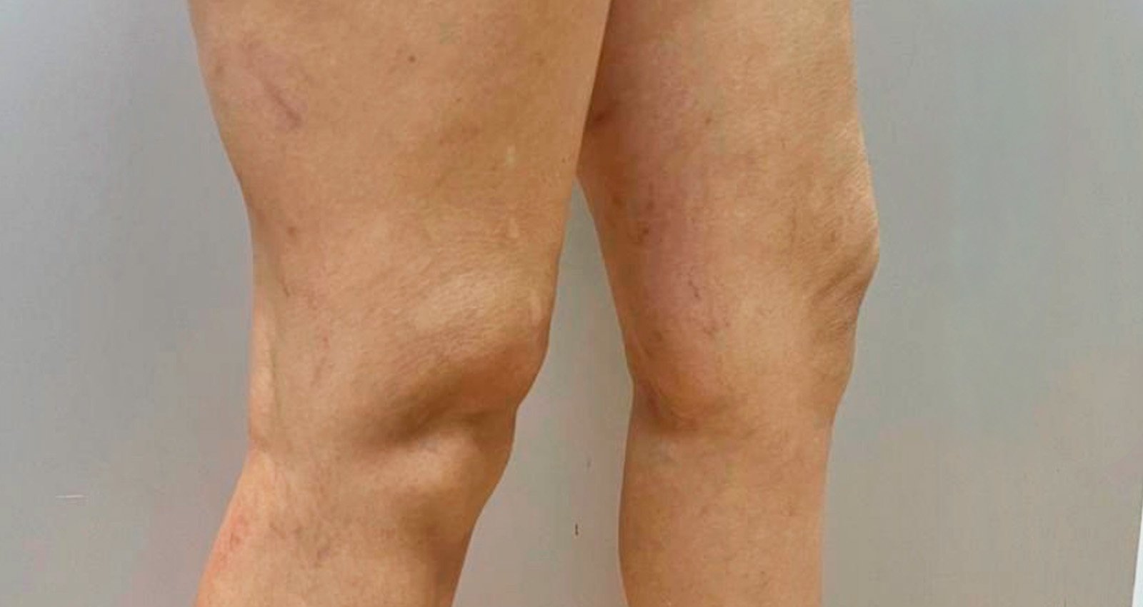 Prancheta 1 copiar 5